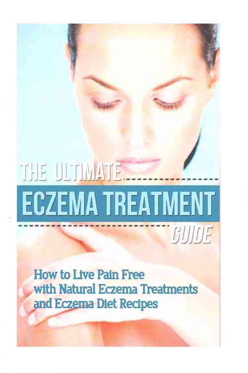 The Ultimate Eczema Treatment Guide: How to Live Pain Free with Natural Eczema Treatments and Eczema Diet Recipes