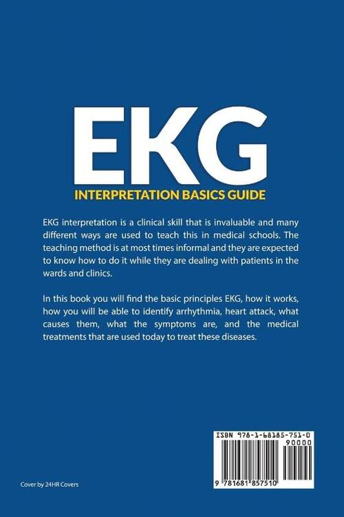 EKG Interpretation Basics Guide