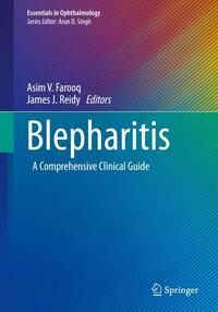 Blepharitis